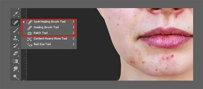 حذف لکه با Spot Healing Brush 